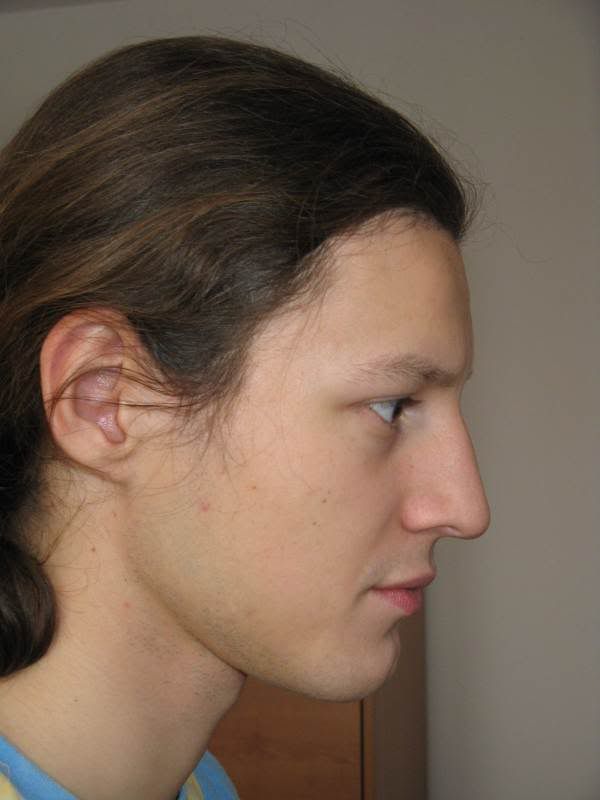 Posted Image